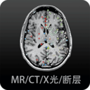 影像解剖图谱-CT MR 断层 病例
