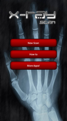 X-ray Scan