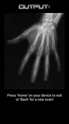 【免費生活App】X-ray Scan-APP點子