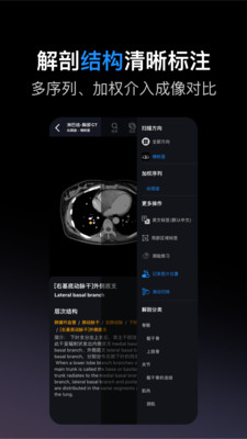 影像解剖图谱-CT MR 断层 病例