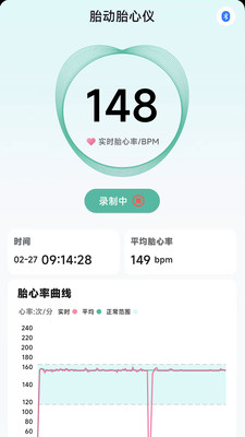 天使脉动-守护孕期美好
