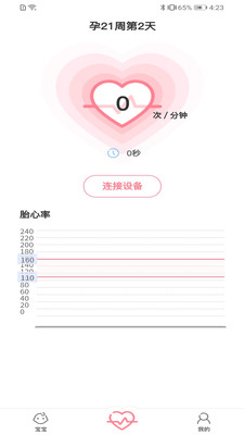 fetalheart胎心仪