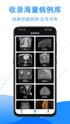 影像解剖图谱-CT MR 断层 病例