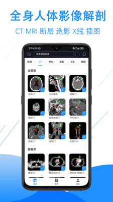 影像解剖图谱-CT MR 断层 病例