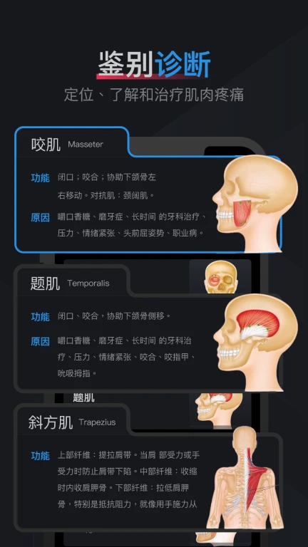 肌肉激痛点图谱