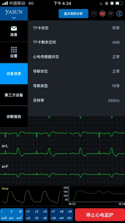 多参数检测