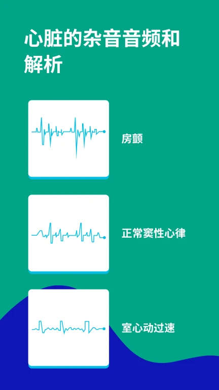 心电图ECG