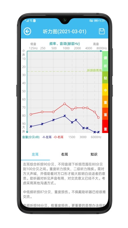 见声听力检测