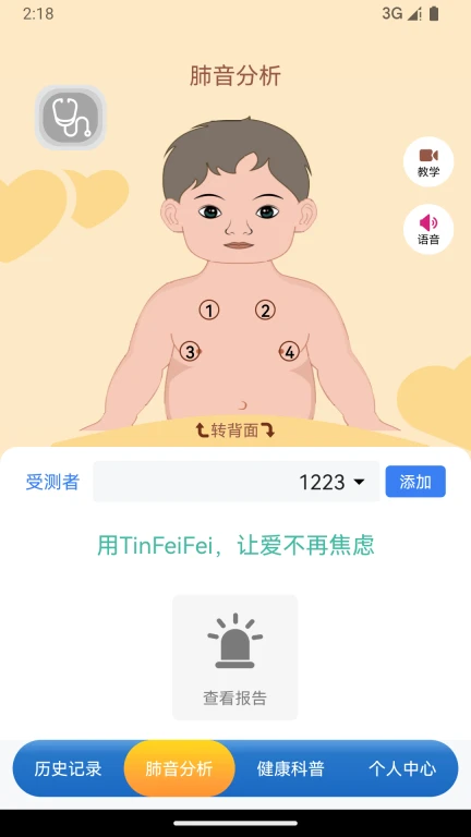 TinFeiFei